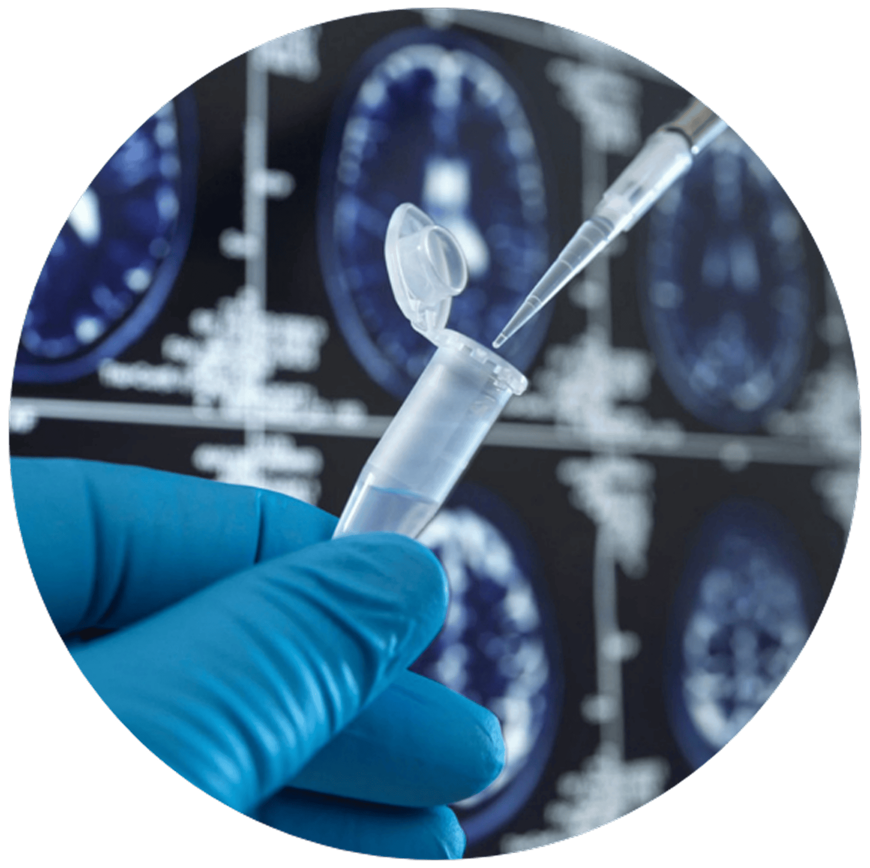 A gloved hand pipettes liquid into a vial against a blurred background of brain scans, conveying a sense of scientific research or medical analysis.