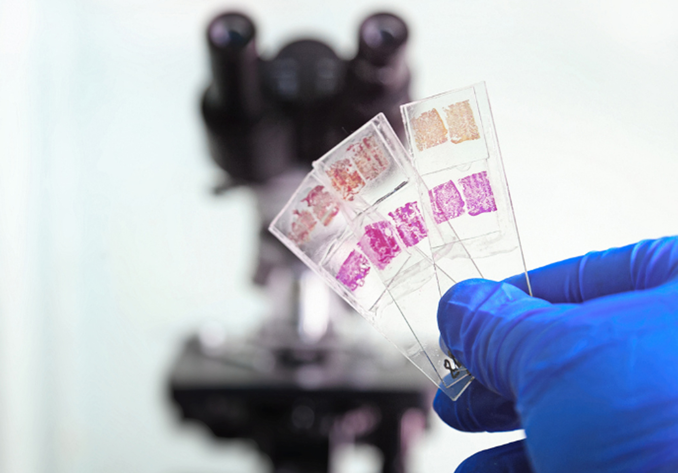 A gloved hand holds three glass slides with stained specimens, in focus, in front of a blurred microscope background, suggesting a lab setting.
