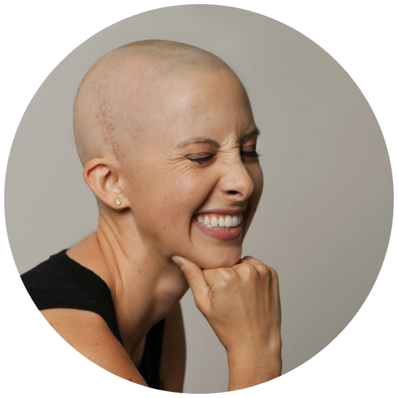 Portrait of a woman in a black shirt, her hand under her chin, smiling with her eyes closed and showing a scar on her head from brain tumor surgery.