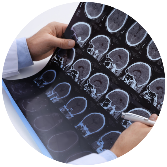 A physician's hands hold up a brain scan MRI